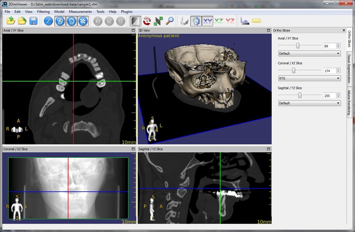 3DimViewer - Presented by PostDICOM